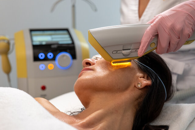 Fotorejuvenace obličeje pomocí pulzního světla