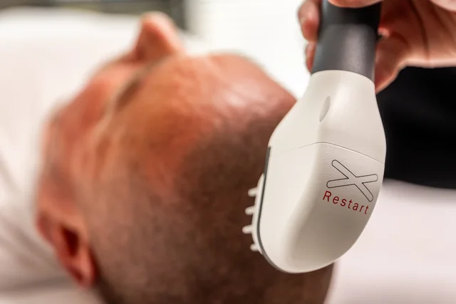 Obnova růstu vlasů pro muže