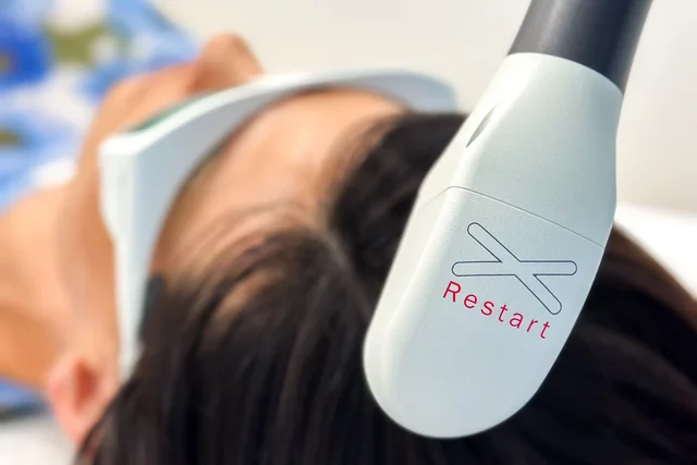 Obnova růstu vlasů pomocí biotechnologie