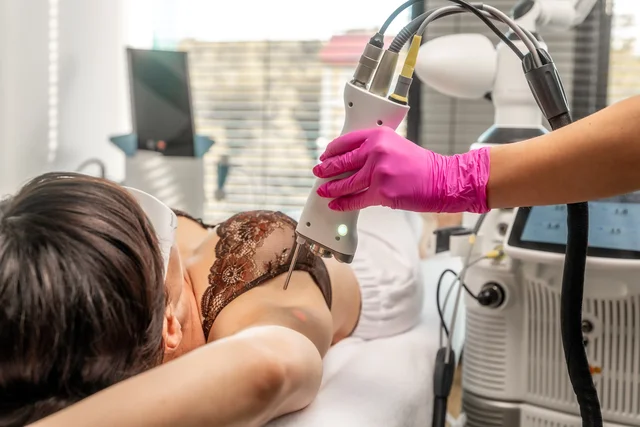 Trvalá laserová epilace