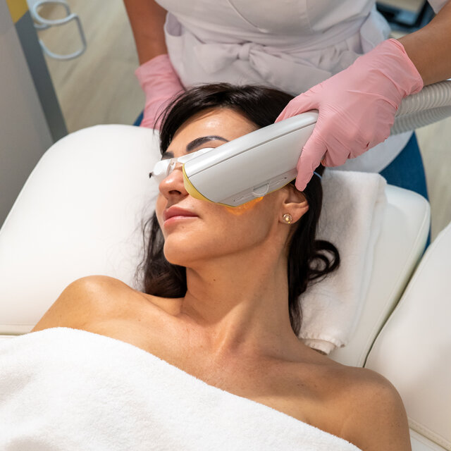 Trvalá epilace obličeje pomocí IPL